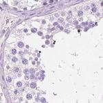 CUZD1 Antibody in Immunohistochemistry (IHC)