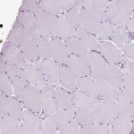 FXYD2 Antibody in Immunohistochemistry (Paraffin) (IHC (P))