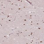 MED6 Antibody in Immunohistochemistry (Paraffin) (IHC (P))