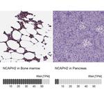 NCAPH2 Antibody in Immunohistochemistry (IHC)