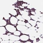 NCAPH2 Antibody in Immunohistochemistry (IHC)