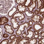 UBXN2A Antibody in Immunohistochemistry (Paraffin) (IHC (P))