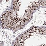 TOE1 Antibody in Immunohistochemistry (IHC)