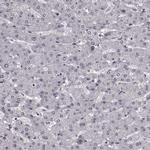 TOE1 Antibody in Immunohistochemistry (IHC)