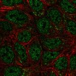 SEMA4A Antibody in Immunocytochemistry (ICC/IF)