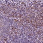 SEMA4A Antibody in Immunohistochemistry (IHC)