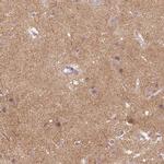 Neuroligin 2 Antibody in Immunohistochemistry (Paraffin) (IHC (P))