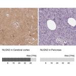 Neuroligin 2 Antibody in Immunohistochemistry (IHC)