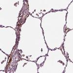 PTX3 Antibody in Immunohistochemistry (Paraffin) (IHC (P))