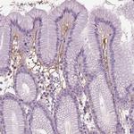 PTX3 Antibody in Immunohistochemistry (Paraffin) (IHC (P))