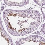 PTX3 Antibody in Immunohistochemistry (Paraffin) (IHC (P))