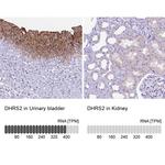 DHRS2 Antibody in Immunohistochemistry (IHC)