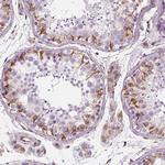 PGAP1 Antibody in Immunohistochemistry (Paraffin) (IHC (P))