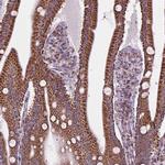 PYCRL Antibody in Immunohistochemistry (Paraffin) (IHC (P))