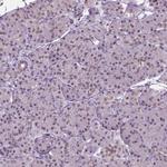 PHAX Antibody in Immunohistochemistry (IHC)