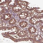 Coronin 1B Antibody in Immunohistochemistry (Paraffin) (IHC (P))