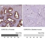 Coronin 1B Antibody in Immunohistochemistry (IHC)