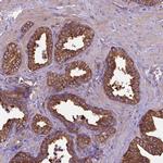 Coronin 1B Antibody in Immunohistochemistry (IHC)