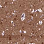 ABI2 Antibody in Immunohistochemistry (IHC)