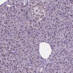 ABI2 Antibody in Immunohistochemistry (IHC)