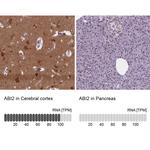 ABI2 Antibody