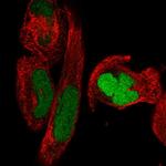 SMC2 Antibody in Immunocytochemistry (ICC/IF)