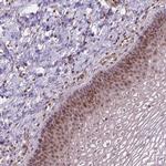 SMC2 Antibody in Immunohistochemistry (Paraffin) (IHC (P))