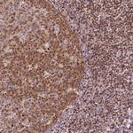 SMC2 Antibody in Immunohistochemistry (Paraffin) (IHC (P))