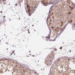 SMC2 Antibody in Immunohistochemistry (Paraffin) (IHC (P))