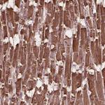 HS3ST3A1 Antibody in Immunohistochemistry (Paraffin) (IHC (P))