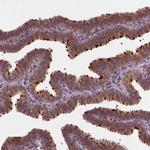 NIPAL2 Antibody in Immunohistochemistry (Paraffin) (IHC (P))