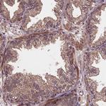 NIPAL2 Antibody in Immunohistochemistry (Paraffin) (IHC (P))