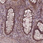 NIPAL2 Antibody in Immunohistochemistry (Paraffin) (IHC (P))