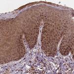 NIPAL2 Antibody in Immunohistochemistry (Paraffin) (IHC (P))