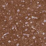 CSPG5 Antibody in Immunohistochemistry (Paraffin) (IHC (P))