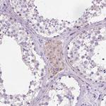 CSPG5 Antibody in Immunohistochemistry (Paraffin) (IHC (P))