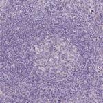 CSPG5 Antibody in Immunohistochemistry (Paraffin) (IHC (P))