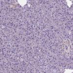 CSPG5 Antibody in Immunohistochemistry (IHC)