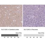 KCC2 Antibody in Immunohistochemistry (IHC)