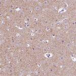 KCC2 Antibody in Immunohistochemistry (IHC)