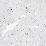 PSD3 Antibody in Immunohistochemistry (Paraffin) (IHC (P))