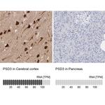 PSD3 Antibody in Immunohistochemistry (IHC)