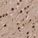 PSD3 Antibody in Immunohistochemistry (IHC)