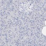 PSD3 Antibody in Immunohistochemistry (IHC)