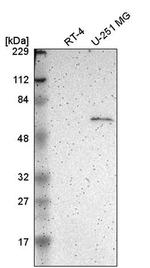 Asparagine Synthetase Antibody in Western Blot (WB)