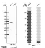 Asparagine Synthetase Antibody