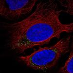 CNST Antibody in Immunocytochemistry (ICC/IF)