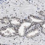 NFIX Antibody in Immunohistochemistry (Paraffin) (IHC (P))