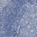 NFIX Antibody in Immunohistochemistry (Paraffin) (IHC (P))