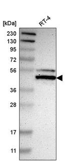 NFIX Antibody in Western Blot (WB)